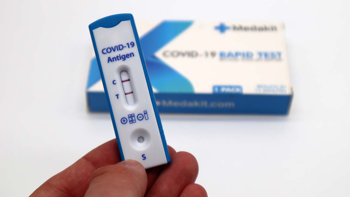 Test na COVID19
